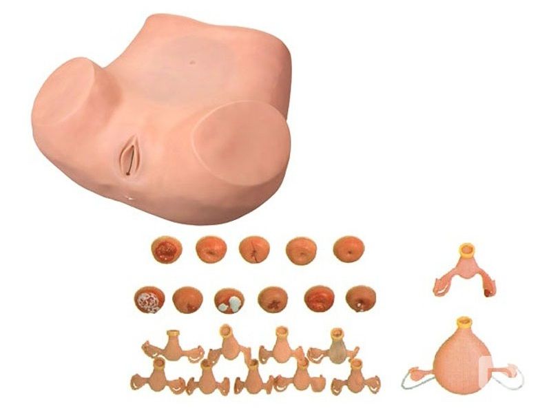  高级妇科检查模型